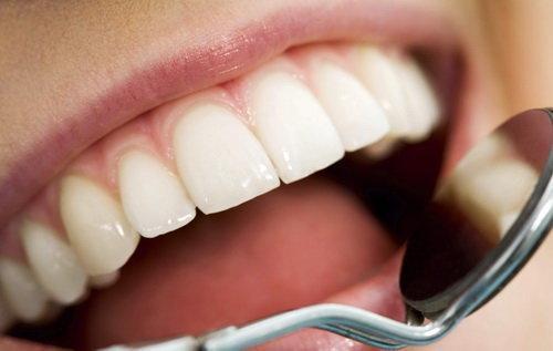 4 روش خانگی برای درمان حساسیت دندان