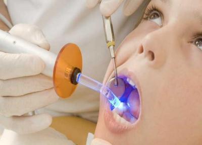 ابداع ماده پُر کردن دندان با ماندگاری دو برابری