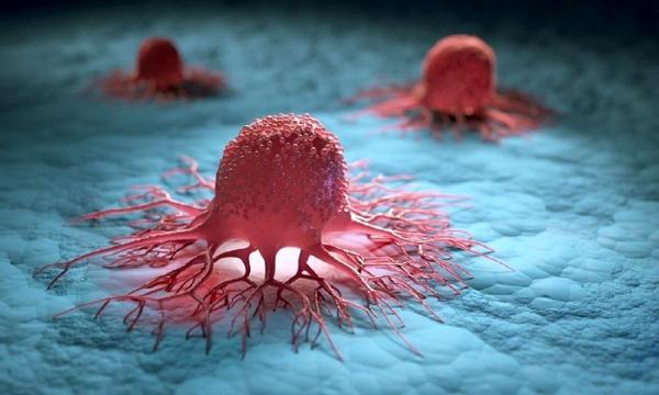 سرطان سینه چگونه در بدن پیشروی می نماید؟