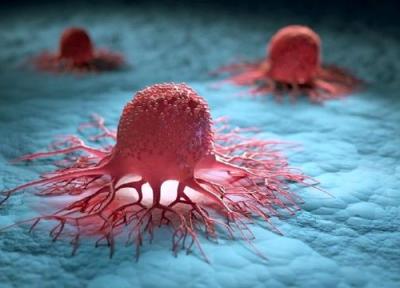 سرطان سینه چگونه در بدن پیشروی می نماید؟